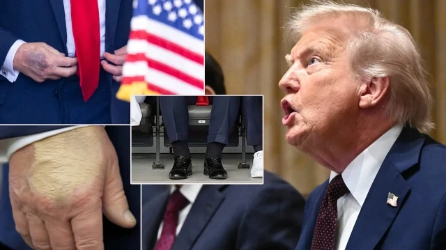 trump 5 gundur kayip vucudundaki degisiklikler dikkat cekmisti YHxnRna8