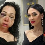 hayati-bir-gunde-degisti-kocaelide-dehseti-yasayan-kadin-konustu-asla-eskisi-gibi-olamayacagim-fLMQPTyF